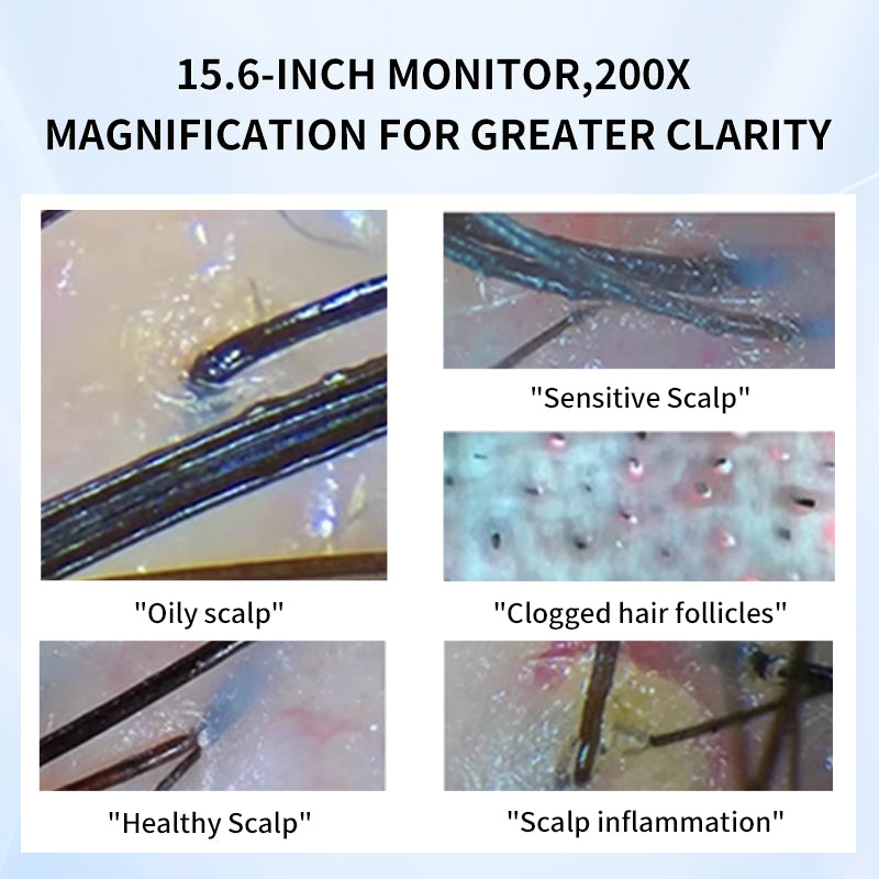 Seyarsi scalp detector AI Skin Scalp Analyzer 15.6 inch HD Scalp treatment Professional Hair Scalp Camera Detector Hair Follicle